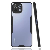 Nettech Xiaomi Mi 11 Lite Uyumlu Platin Seri Arka Koruma Kılıf (Siyah) NT86524
