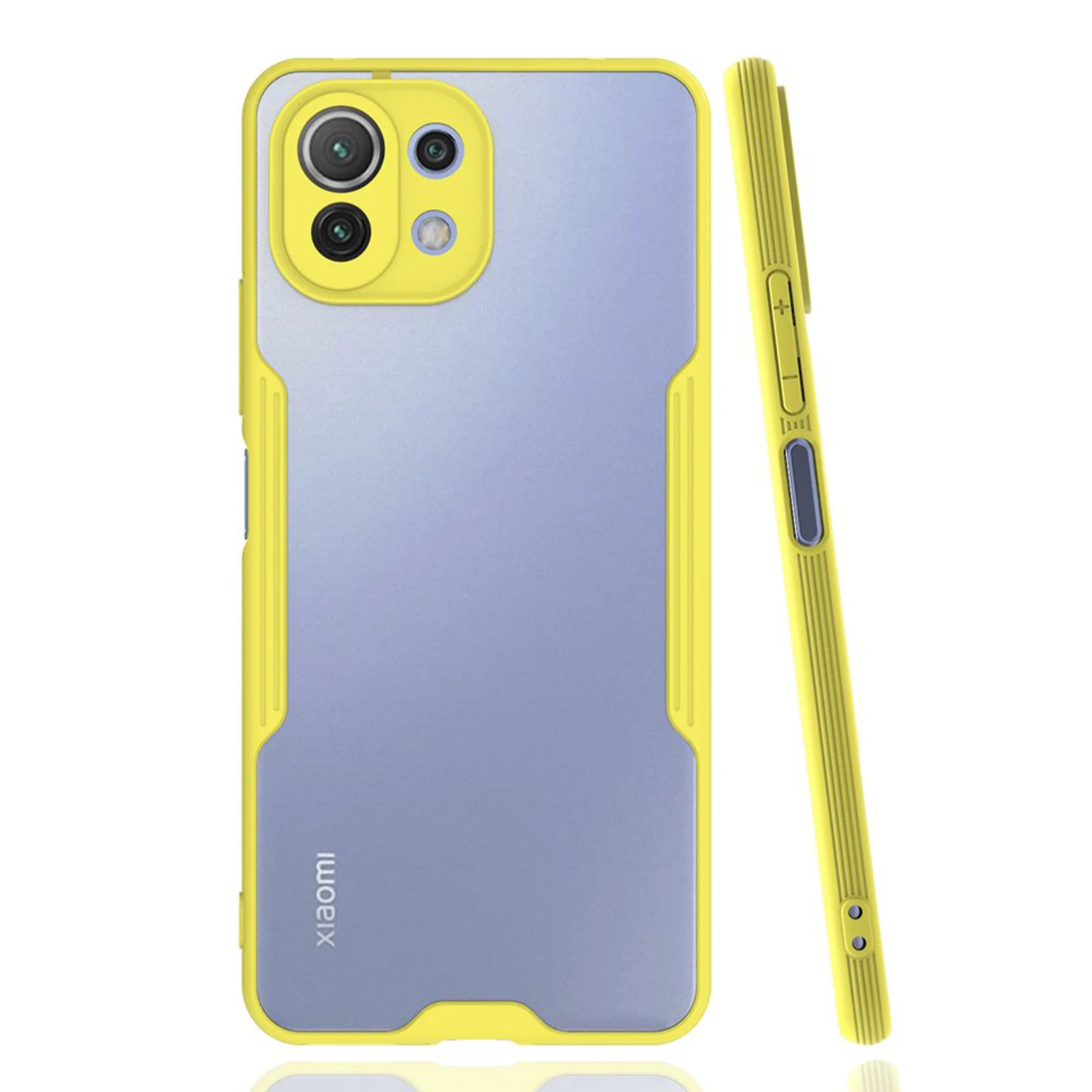Nettech Xiaomi Mi 11 Lite Uyumlu Platin Seri Arka Koruma Kılıf (Sarı) NT-86530