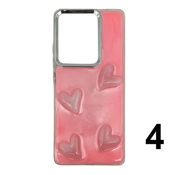 Nettech Xiaomi Redmi Note 13 Pro 4G Uyumlu NT-N048 Arka Koruma Kılıf (Karışık Renk) NT-108770 - 4