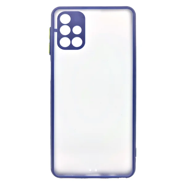 Nettech Samsung Galaxy M31S Uyumlu Kontrast Renkli Tuş Seri Arka Koruma Kılıf (Mavi) NT-88755 - 1