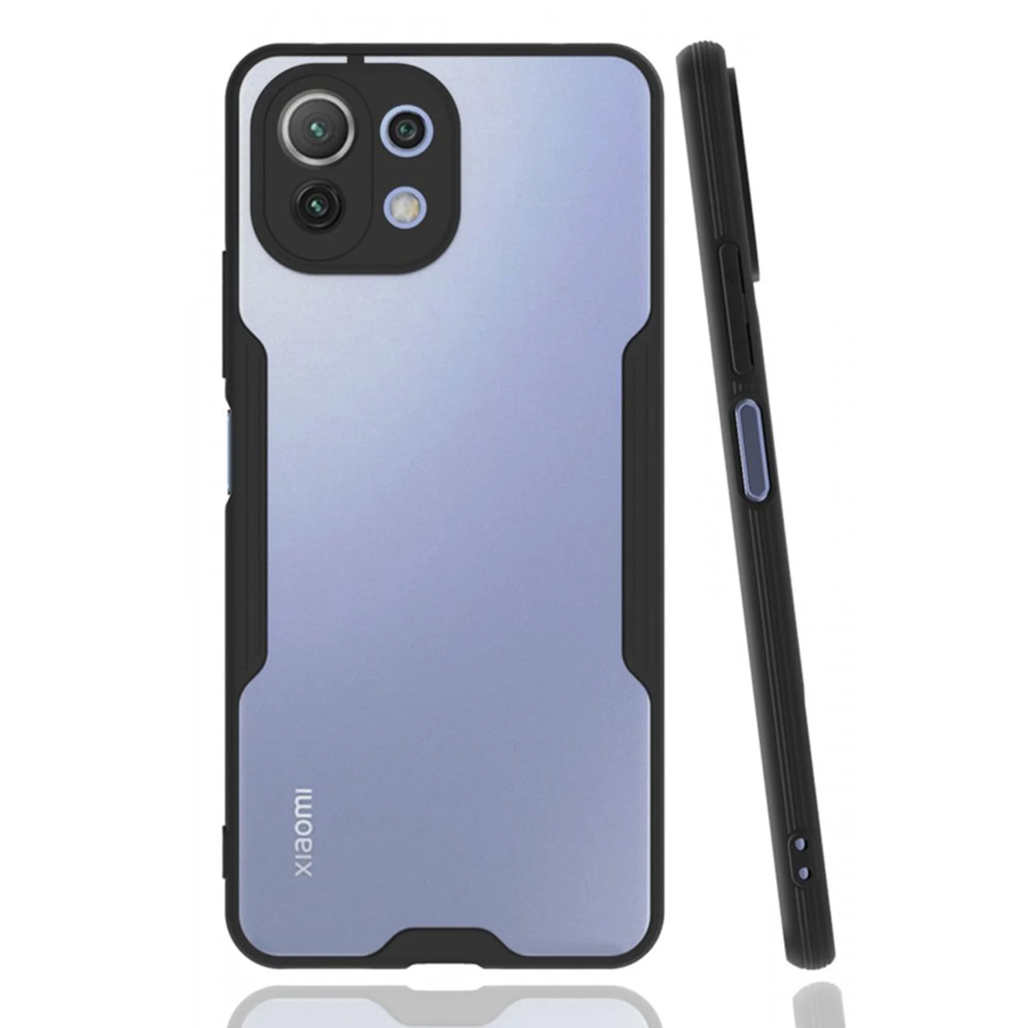 Nettech Xiaomi Mi 11 Lite Uyumlu Platin Seri Arka Koruma Kılıf (Siyah) NT-86524