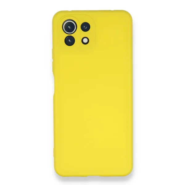 Nettech Xiaomi Mi 11 Lite Uyumlu Nano Arka Koruma Kılıf (Sarı) NT-87701 - 1